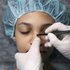 Alaramd Nose® | Non-Surgical Nose Job (NSNJ)
